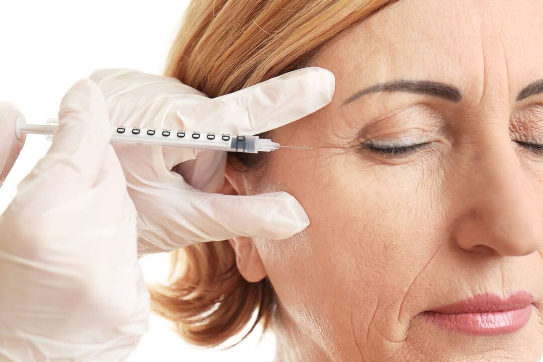 Mesotherapy is a procedure for intradermal administration of rejuvenating drugs. 