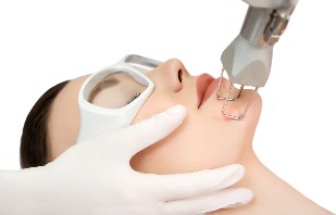 Laser skin rejuvenation of the face